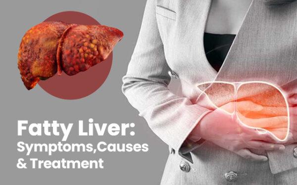 Fatty Liver: Symptoms, Causes & Treatment