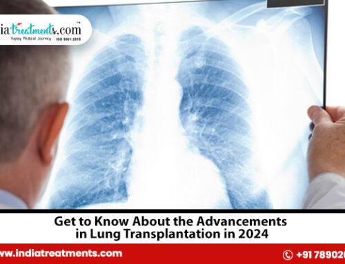 Get to Know About the Advancements in Lung Transplantation in 2024