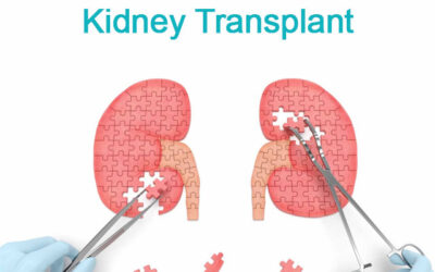 Kidney Transplant