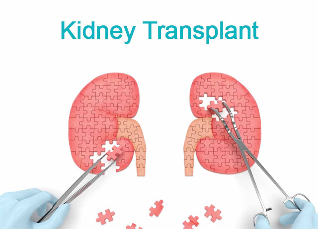 Kidney Transplant