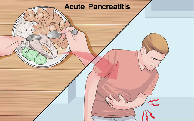 Acute Pancreatitis