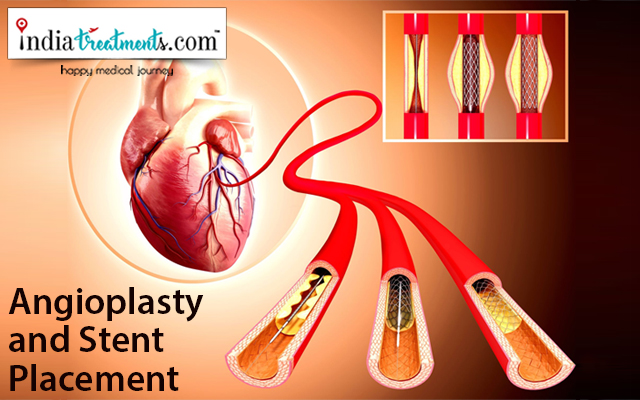 Angioplasty and Stent Placement
