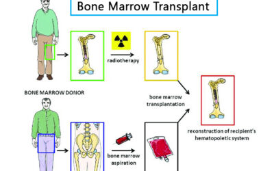 Bone Marrow Transplant