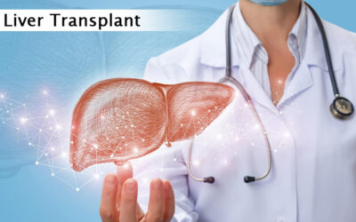 Liver Transplant