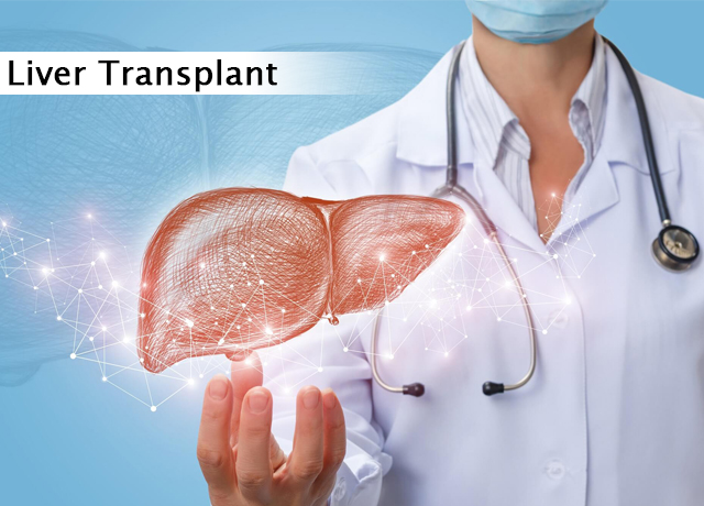 Liver Transplant