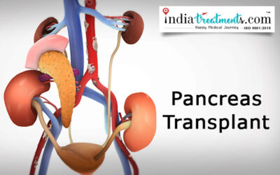 Pancreas Transplant