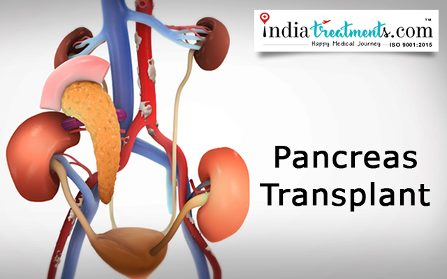 Pancreas Transplant