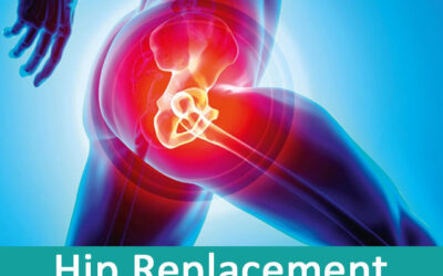 Hip Replacement